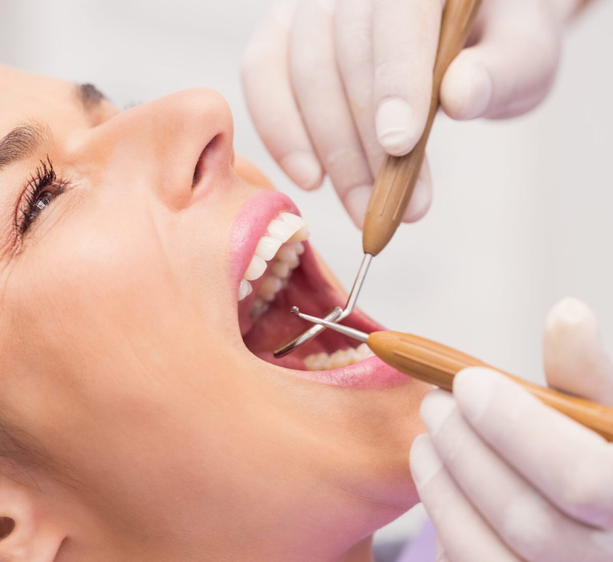 dentist-examining-female-patient-teeth-scaled.jpg